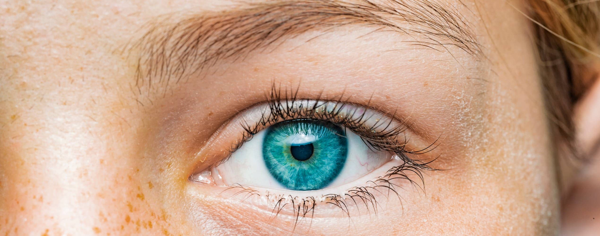 Chirurgie de la cataracte : quel implant choisir ? | Dr Grasswill | Strasbourg
