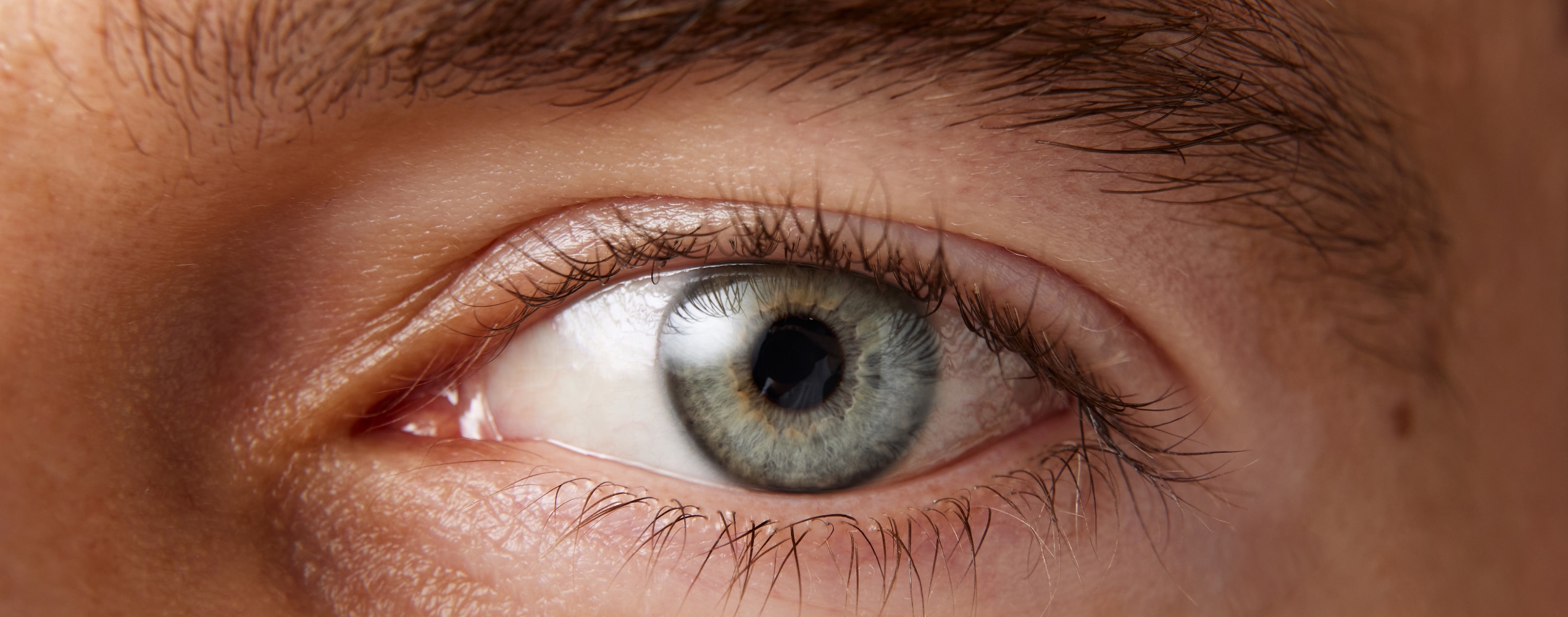 Chirurgie réfractive myopie | Dr Grasswill | Strasbourg