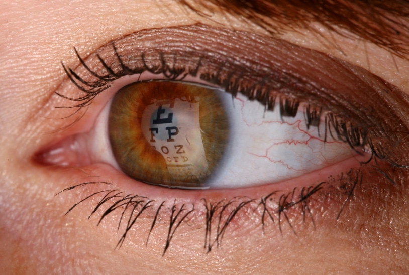 Chirurgie réfractive | Dr Grasswill | Strasbourg